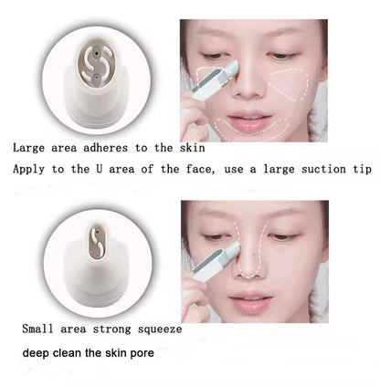 Hydra Dermabrasion Aqua Peeling SPA Beauty Machine Facial Hydration Sprayer Vacuum Blackhead Face Clean